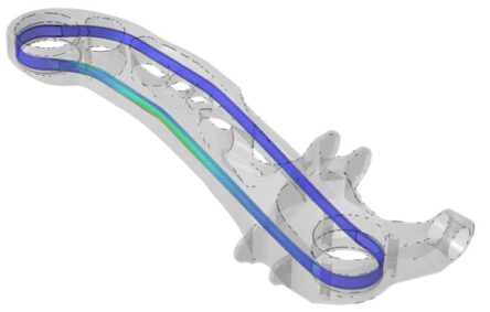 FEA results of the final design: Failure in the fiber skeleton